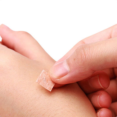 Sharp Tip Acupuncture Point Needles CE TUV ISO GMP For Traditional Chinese Medicine
