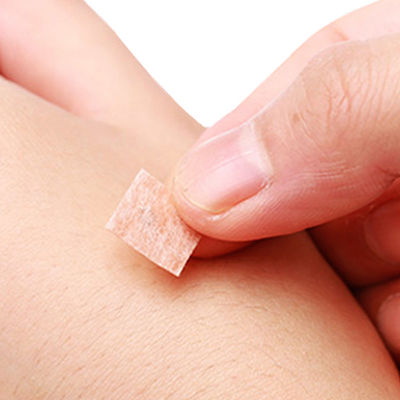Ethylene Oxide Gas Sterilization Method Acu Press Needles CE TUV ISO GMP Certification